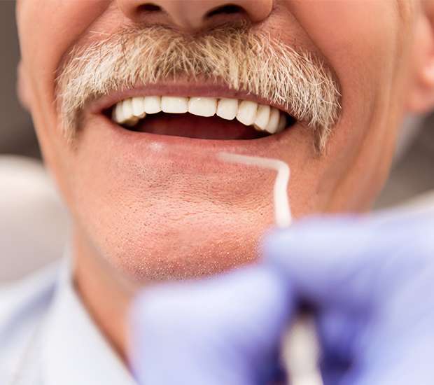 San Rafael Adjusting to New Dentures
