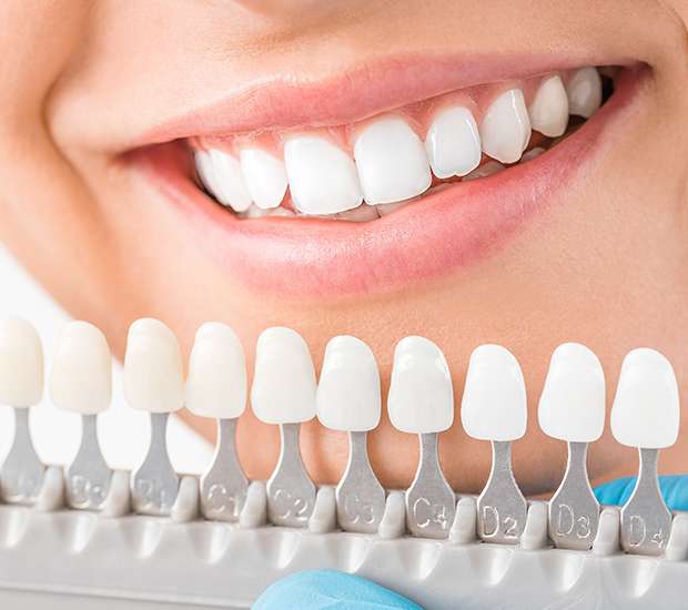 San Rafael Cosmetic Dentist