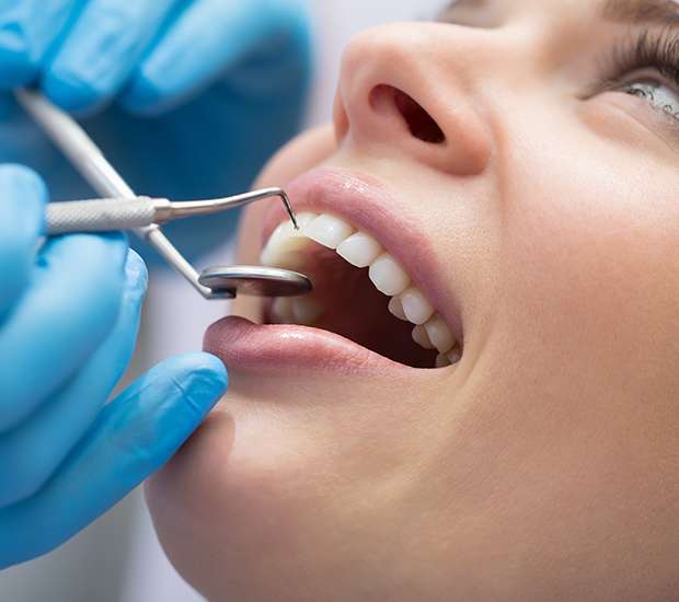 San Rafael Dental Bonding