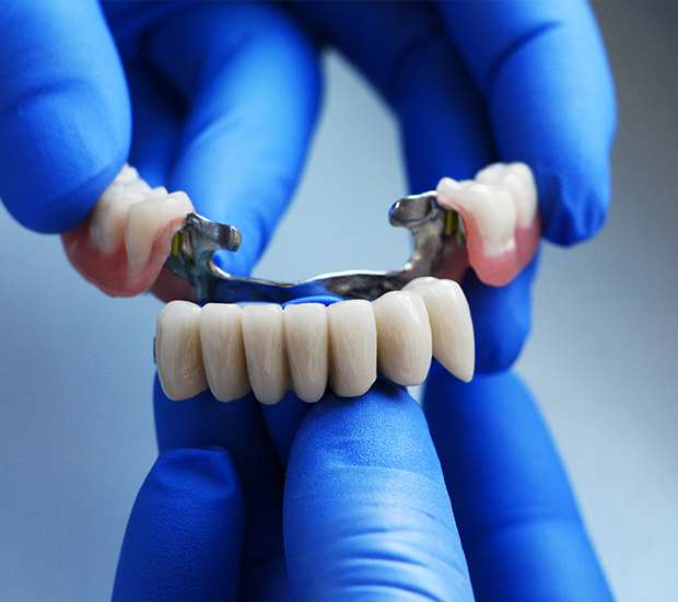 San Rafael Dental Bridges
