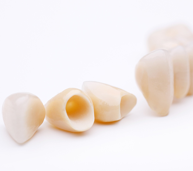 San Rafael Dental Crowns and Dental Bridges