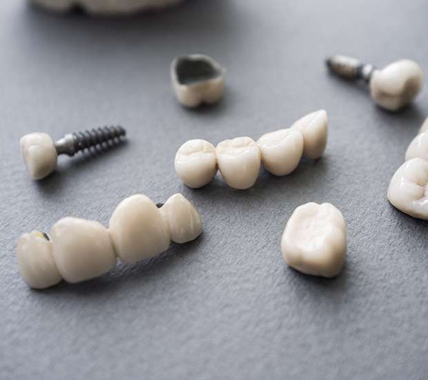 San Rafael The Difference Between Dental Implants and Mini Dental Implants