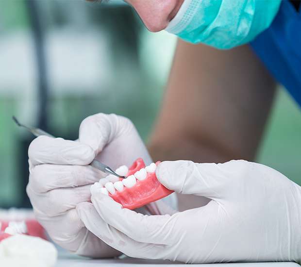 San Rafael Partial Denture for One Missing Tooth