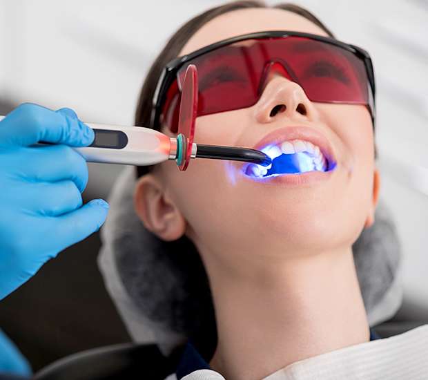 San Rafael Professional Teeth Whitening