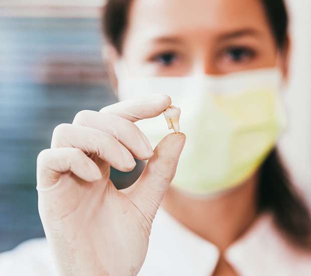 San Rafael Tooth Extraction